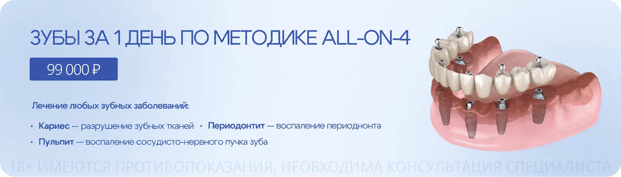 Зубы за 1 день по методике ALL-ON-4