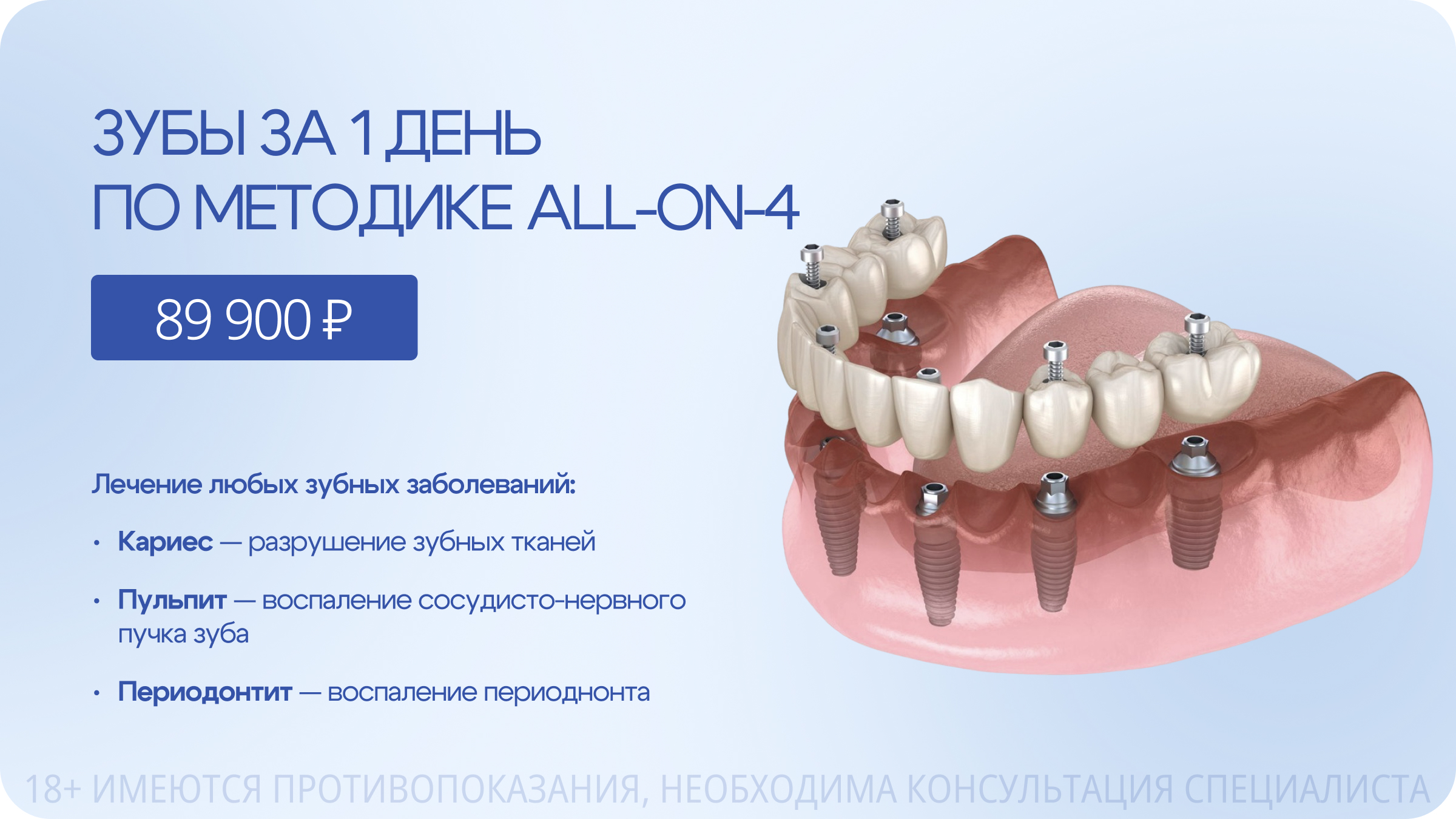Зубы за 1 день по методике ALL-ON-4