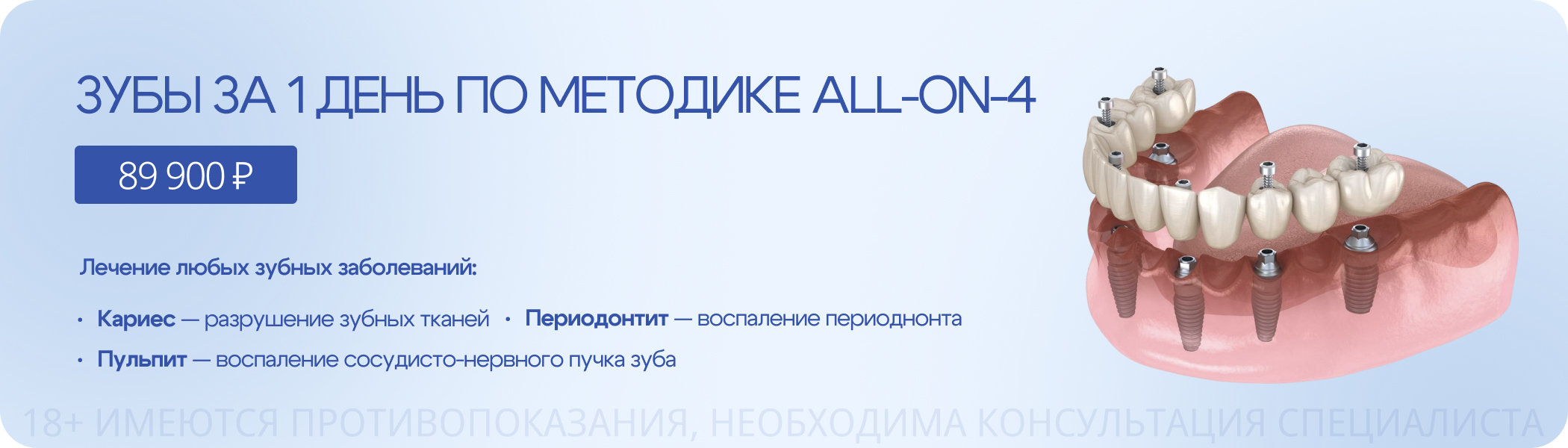 Зубы за 1 день по методике ALL-ON-4