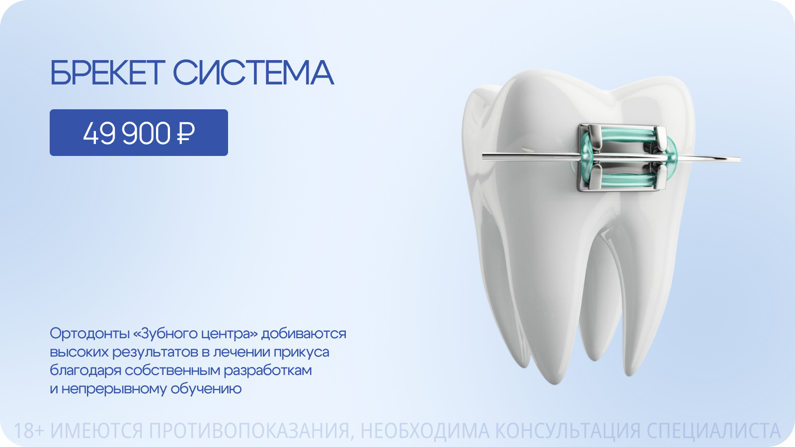Брекет-система