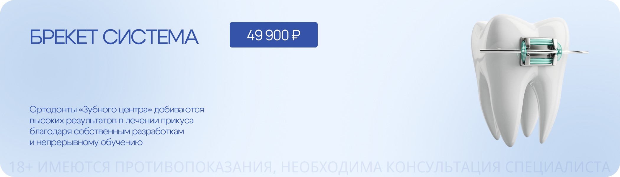 Брекет-система