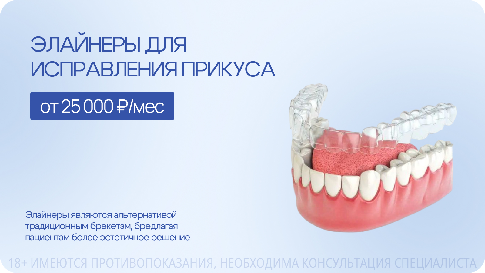 Элайнеры