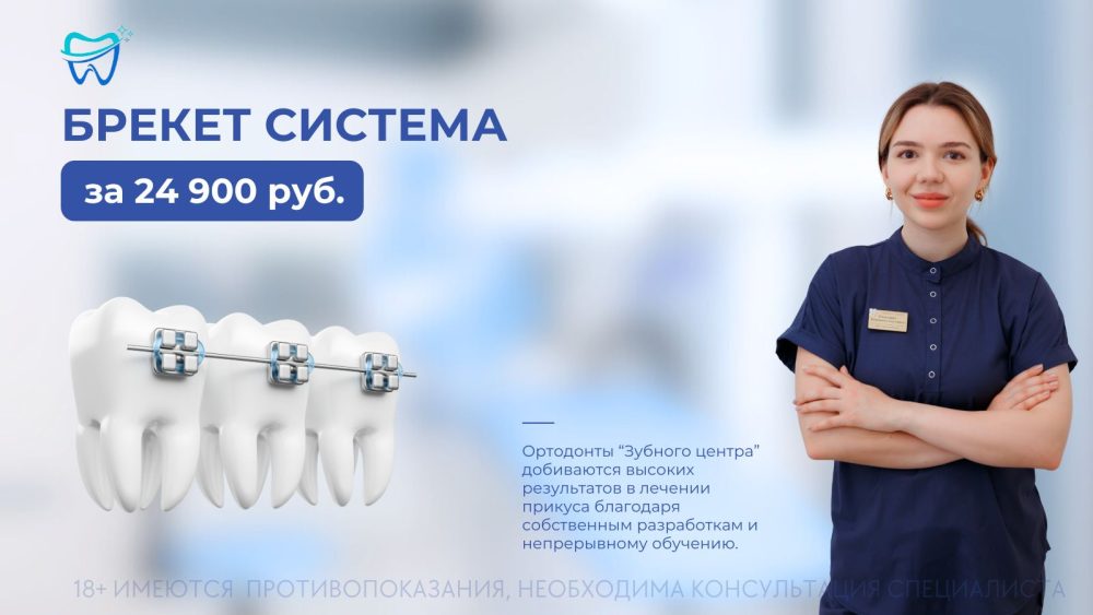 Брекет-система