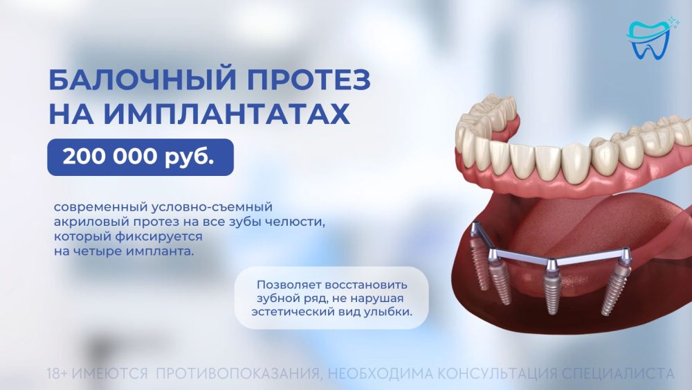 Балочный протез на 4 имплантах