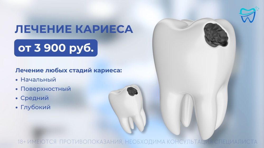 Лечение кариеса от 3900 рублей