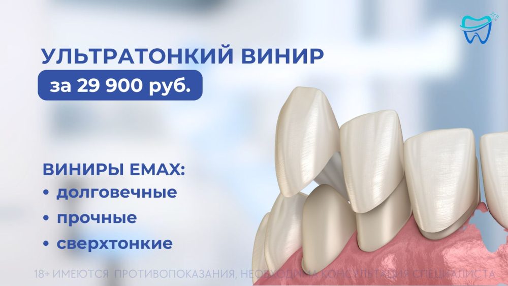 Ультратонкий винир E-Max