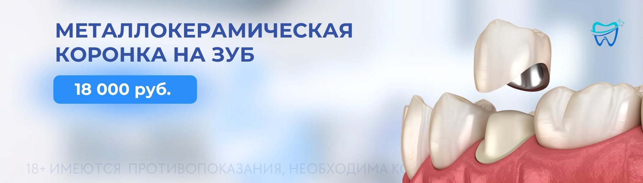 Металлокерамическая коронка