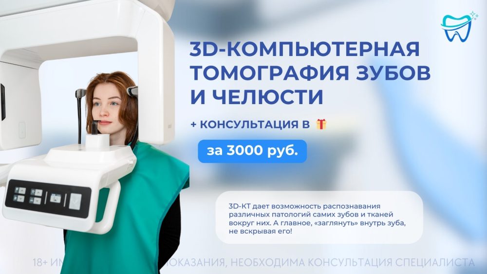 3D-компьютерная томография зубов и челюсти за 2500 руб. + консультация любого специалиста клиники в подарок!