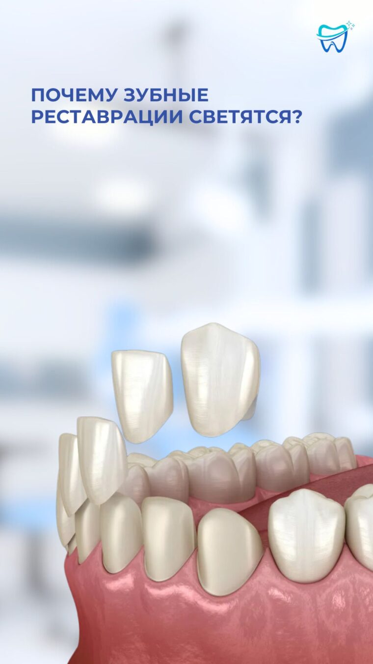 Обложка к видео отзыву: Почему зубные реставрации светятся?