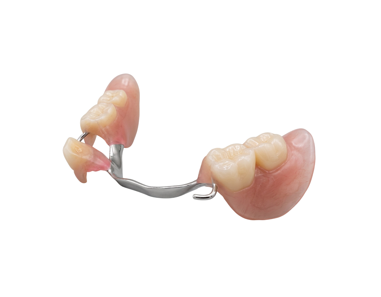 Имплант Бюгельные протезы