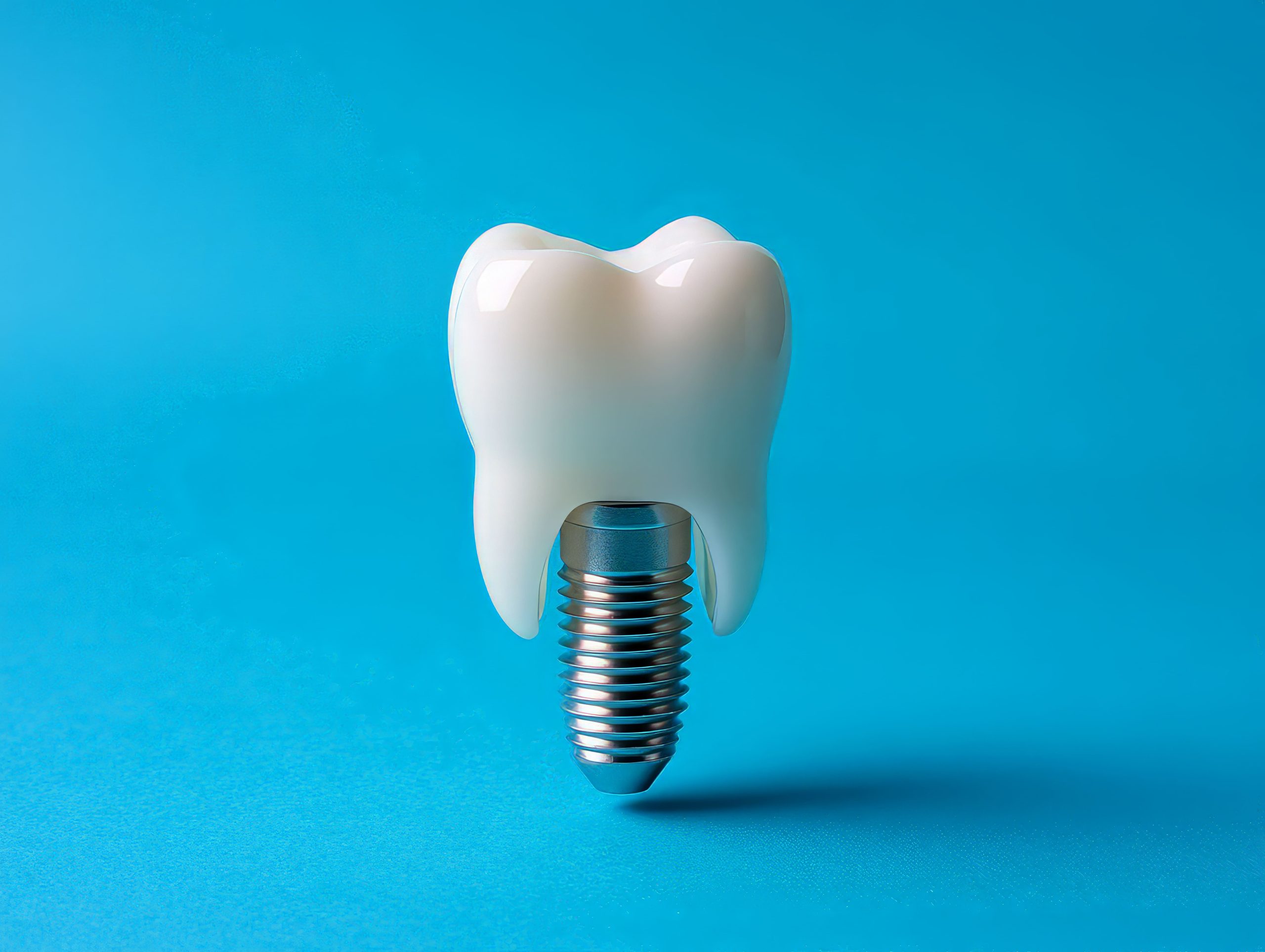 Импланты с гарантией в Санкт-Петербурге: что влияет на срок службы импланта Osstem | Зубной Центр СПБ