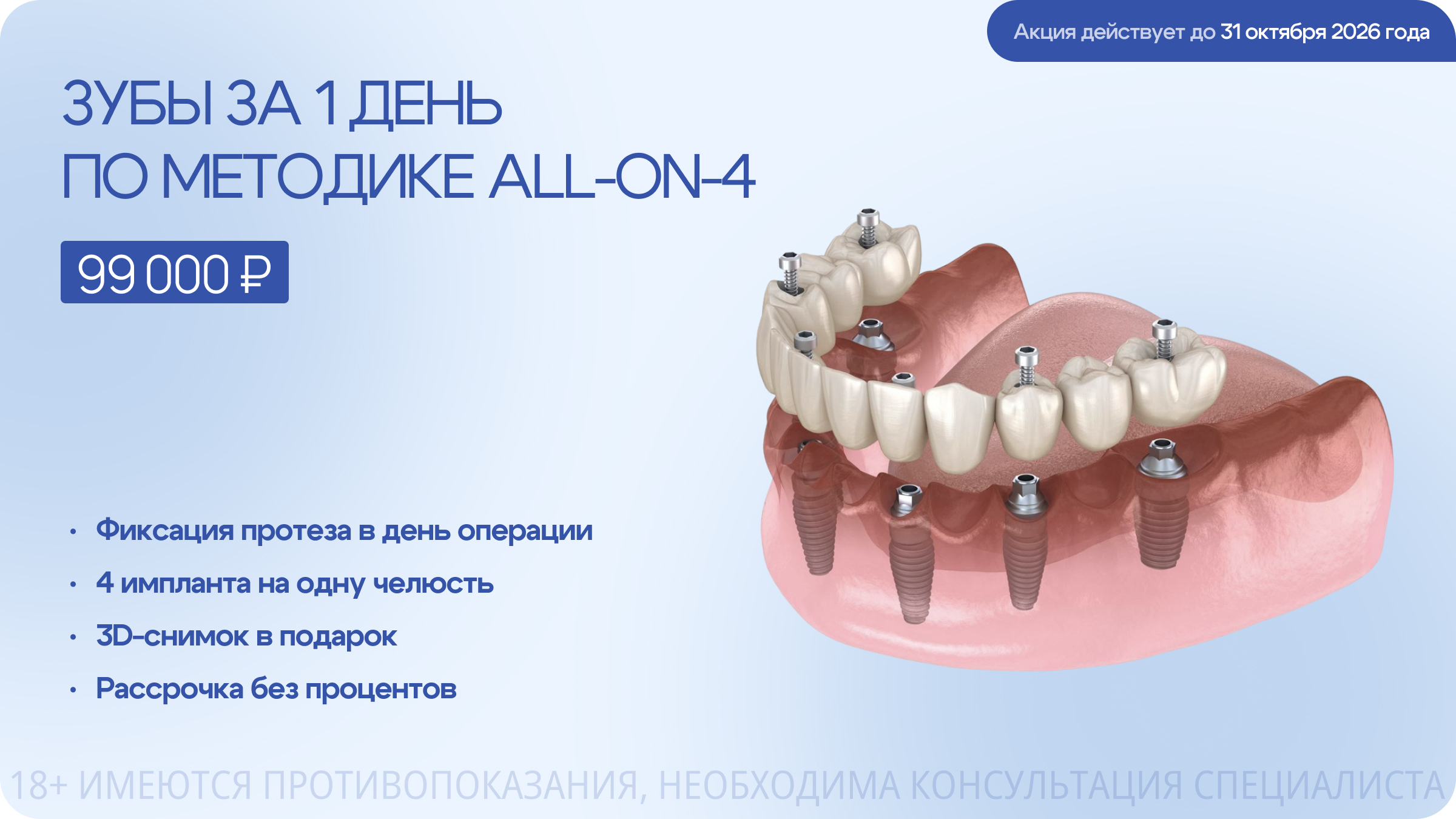 Зубы за 1 день по методике ALL-ON-4