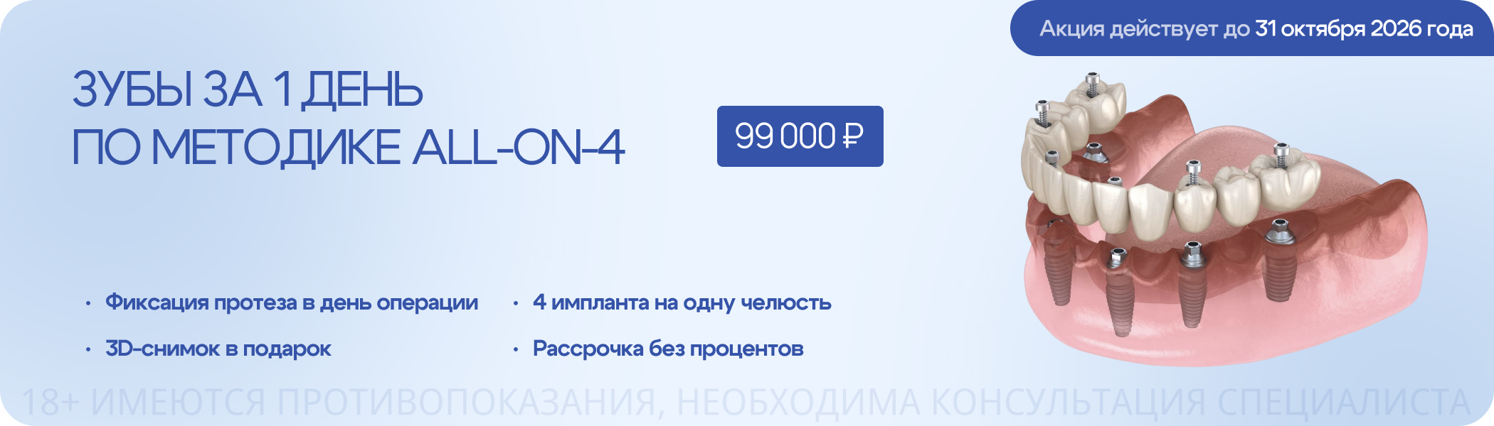 Зубы за 1 день по методике ALL-ON-4