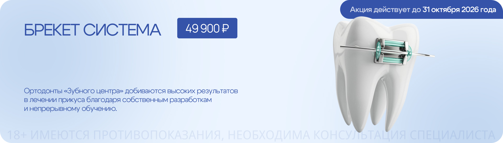 Брекет-система