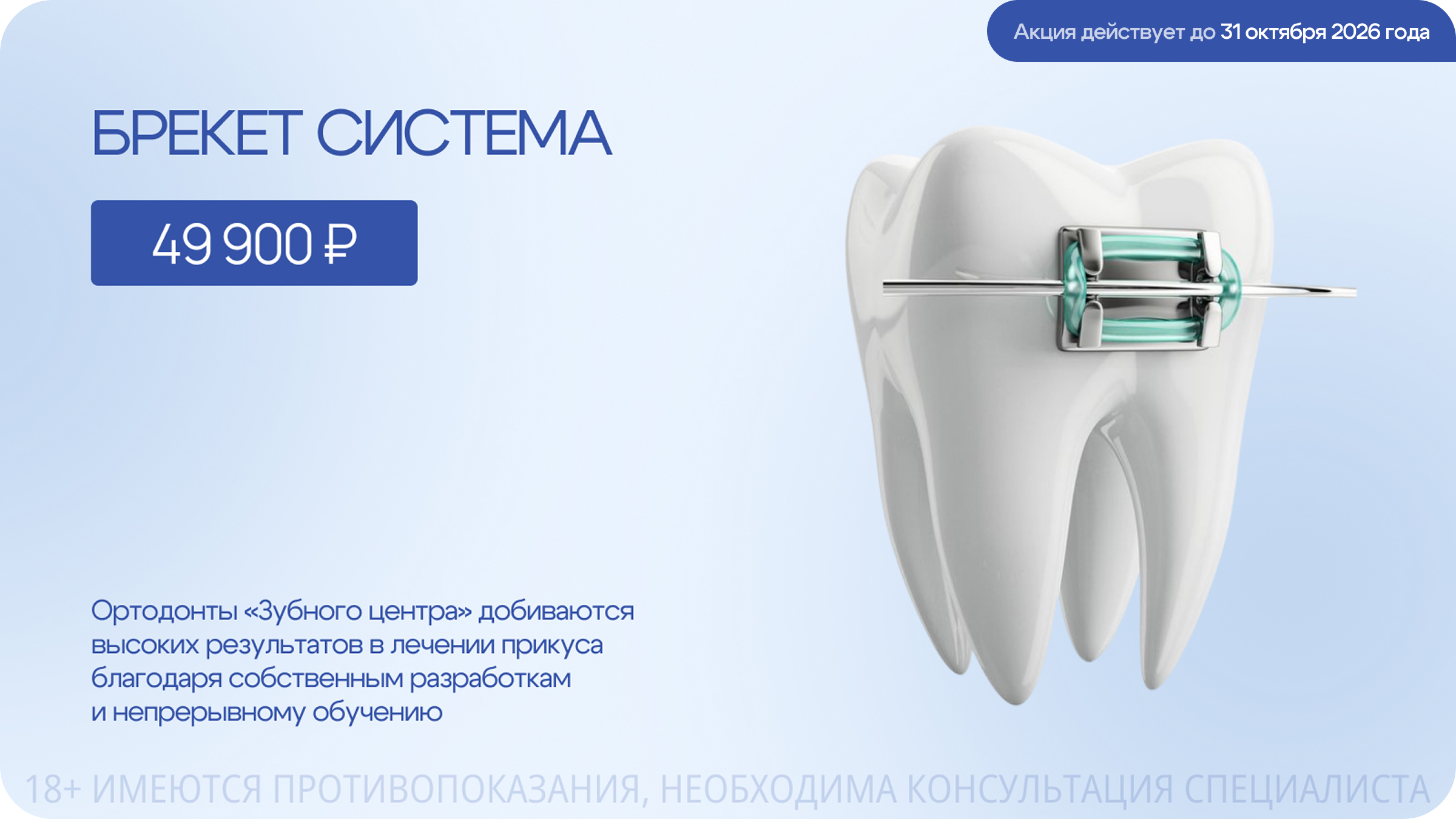 Брекет-система